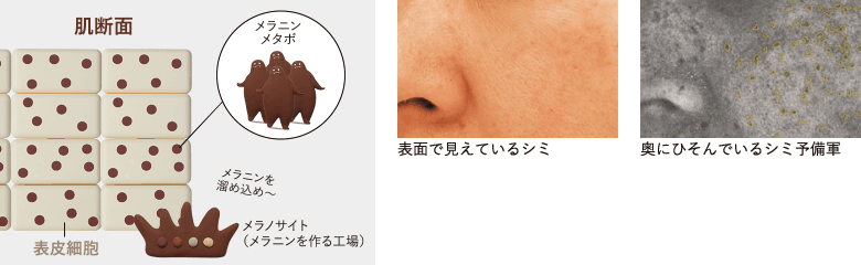 図：肌断面＋写真：表面で見えているシミ＋写真：奥にひそんでいるシミ予備軍