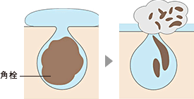 イメージ図