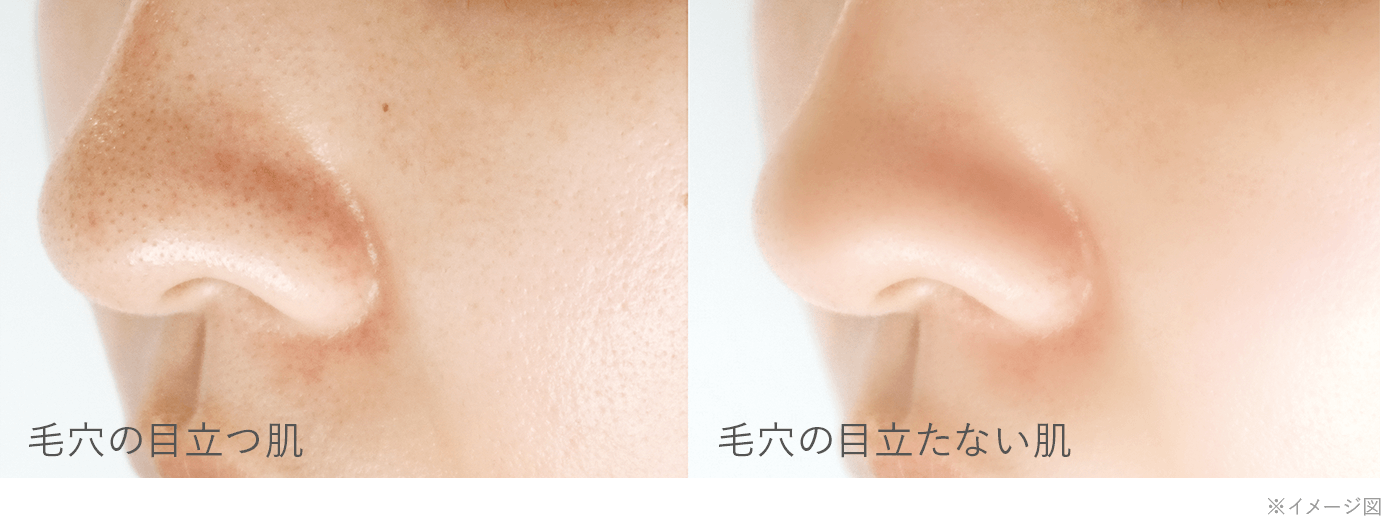 毛穴の目立つ肌と毛穴の目立たない肌の比較画像（※イメージ図）