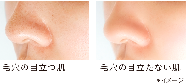 毛穴の目立つ肌／毛穴の目立たない肌 *イメージ