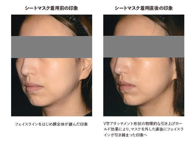 シートマスク着用前の印象 フェイスラインをはじめ顔全体が緩んだ印象/シートマスク着用直後の印象 V字アタッチメント形状の物理的な引き上げホールド効果により、マスクを外した直後にフェイスラインが引き締まった印象へ
