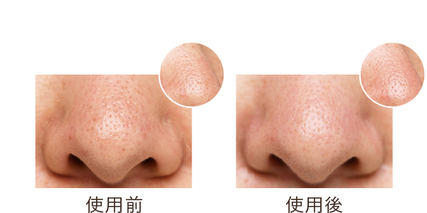 使用前／使用後