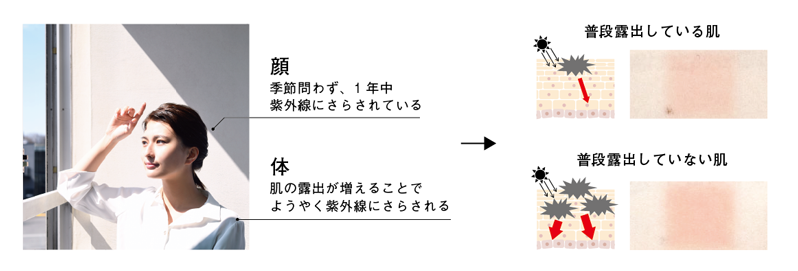 画像：日焼けの原因となる炎症は、顔より体の方が起こりやすいことが判明！
