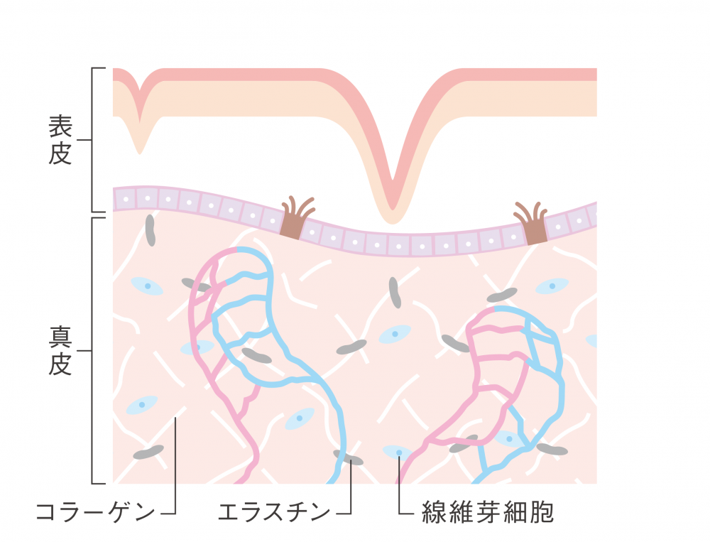 シワ・たるみがある肌